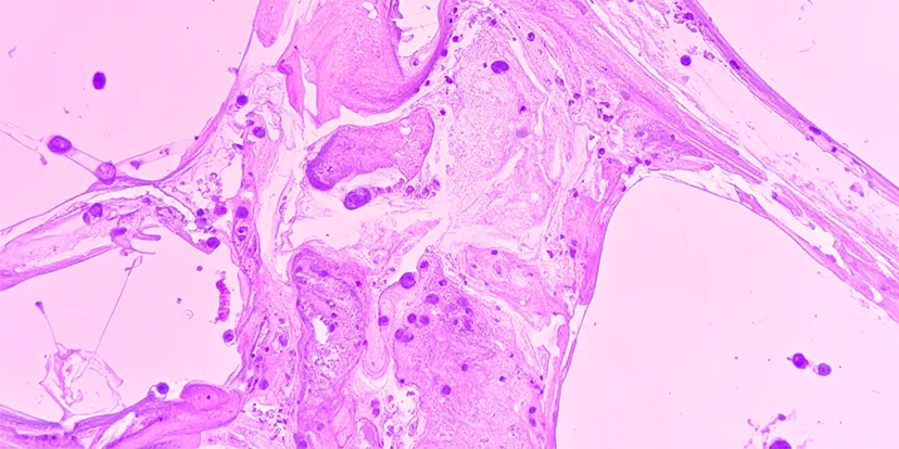 Yeast cells viewed under a microscope
